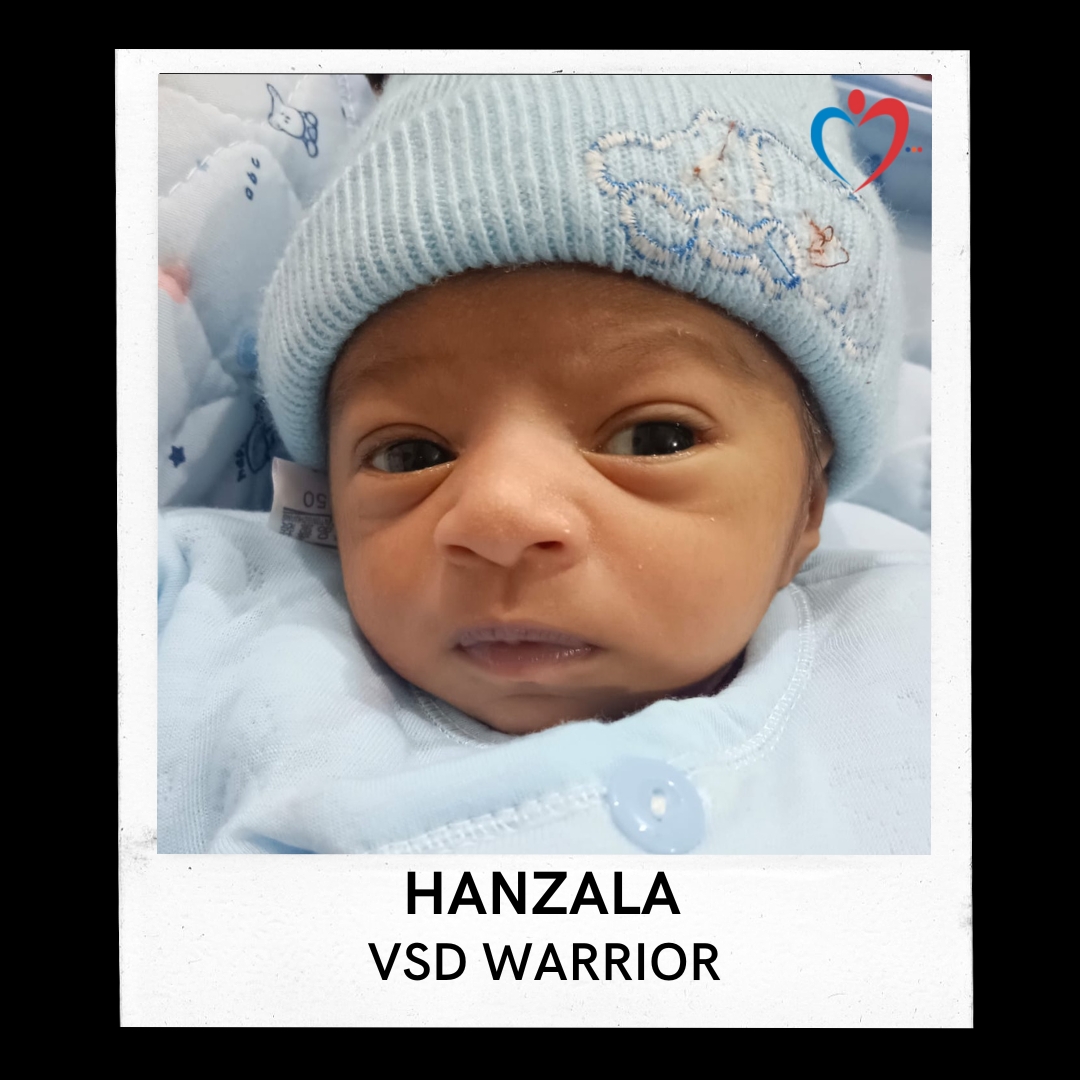 HANZALA