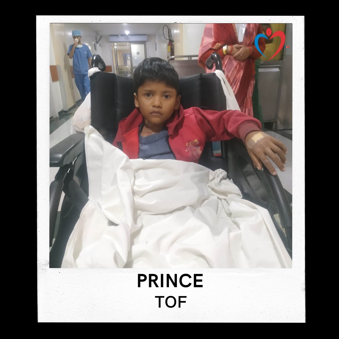 PRINCE