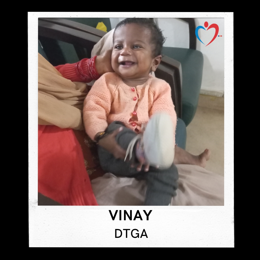 Vinay