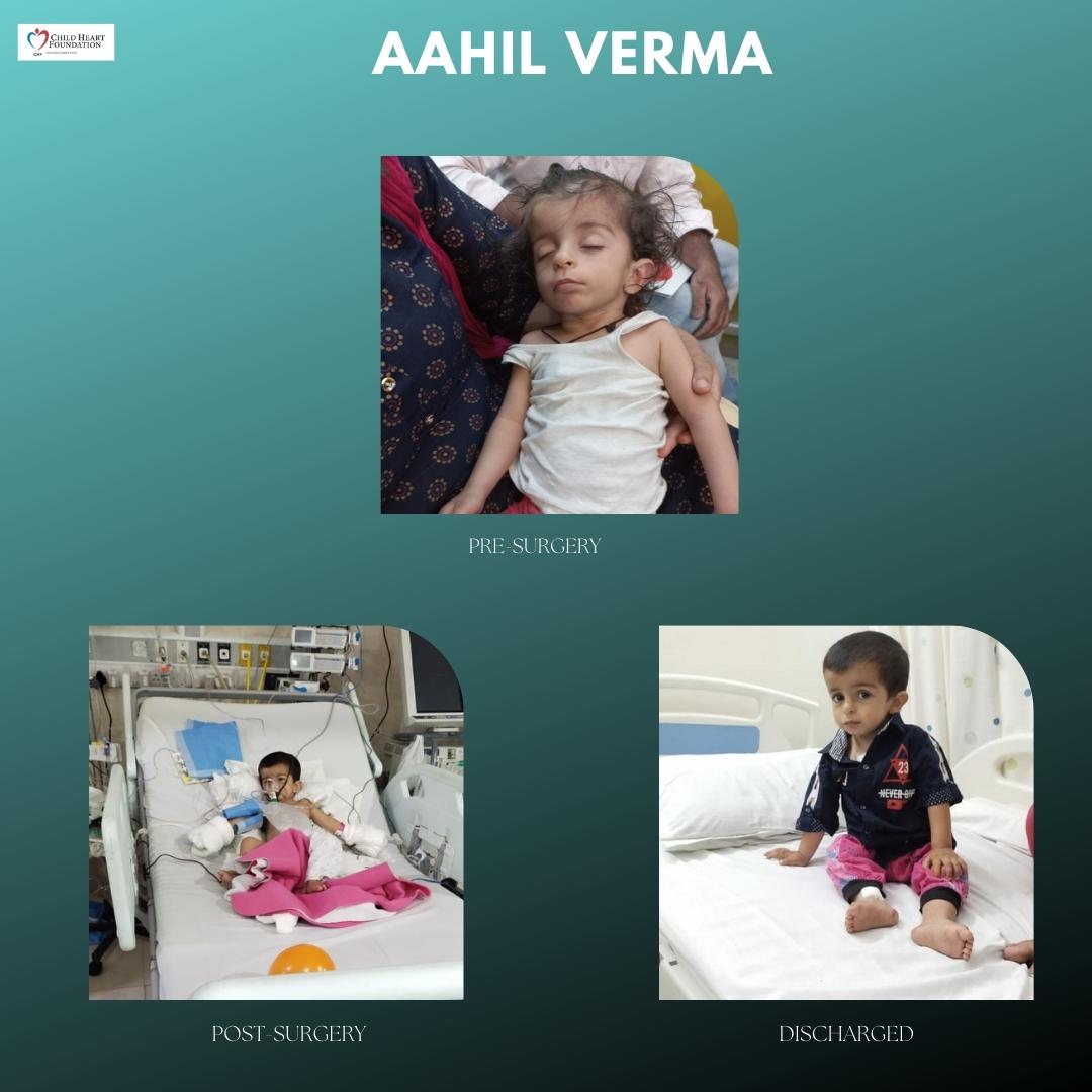 Aahil Verma
