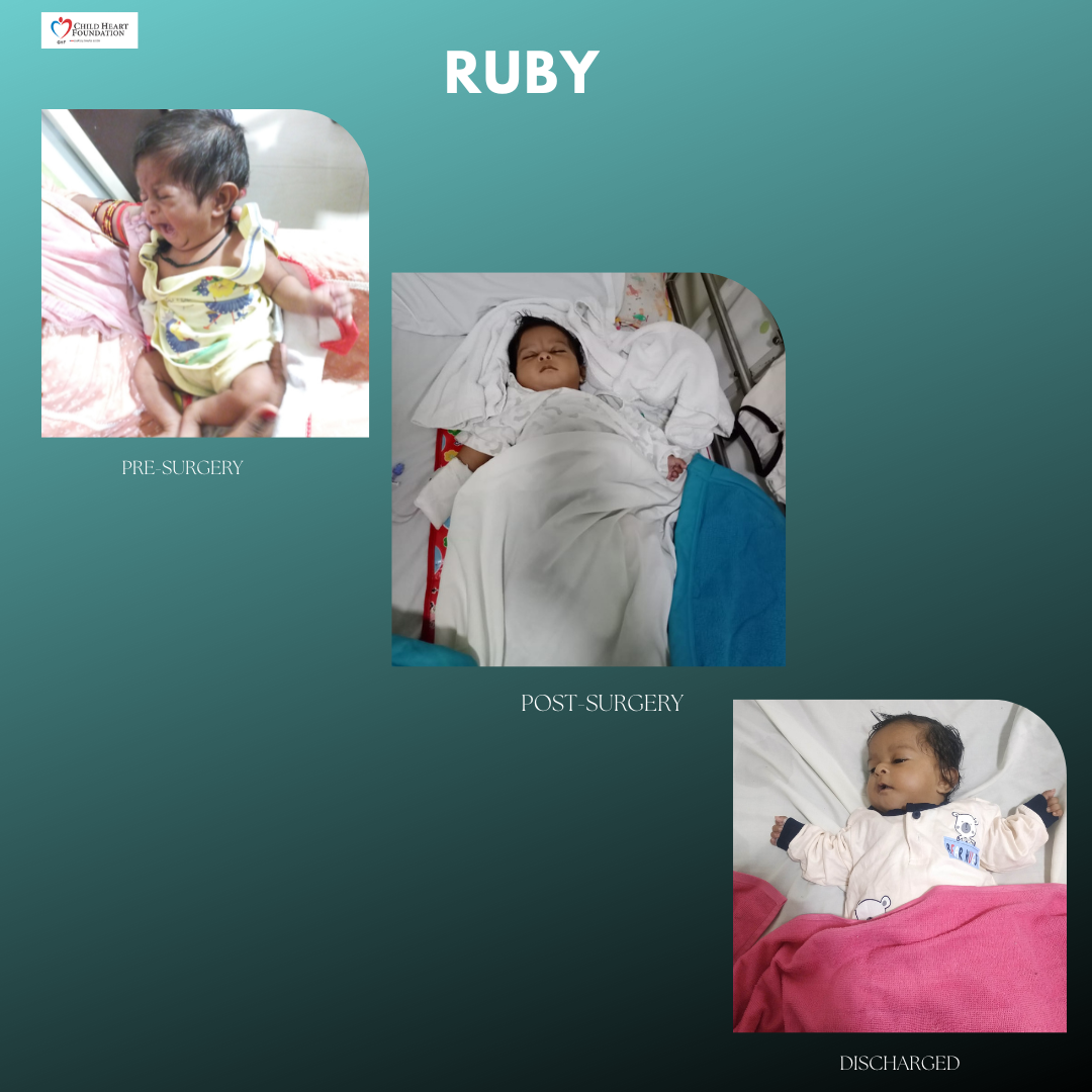 RUBY