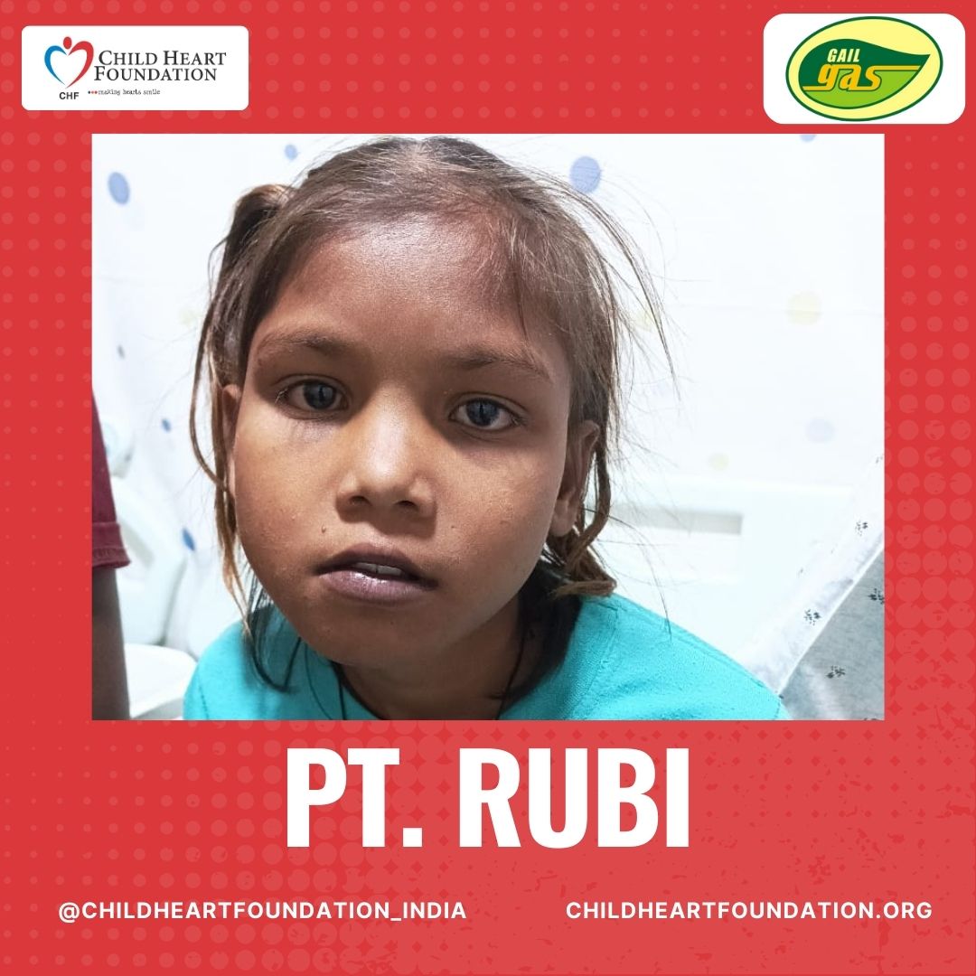 Pt. Rubi